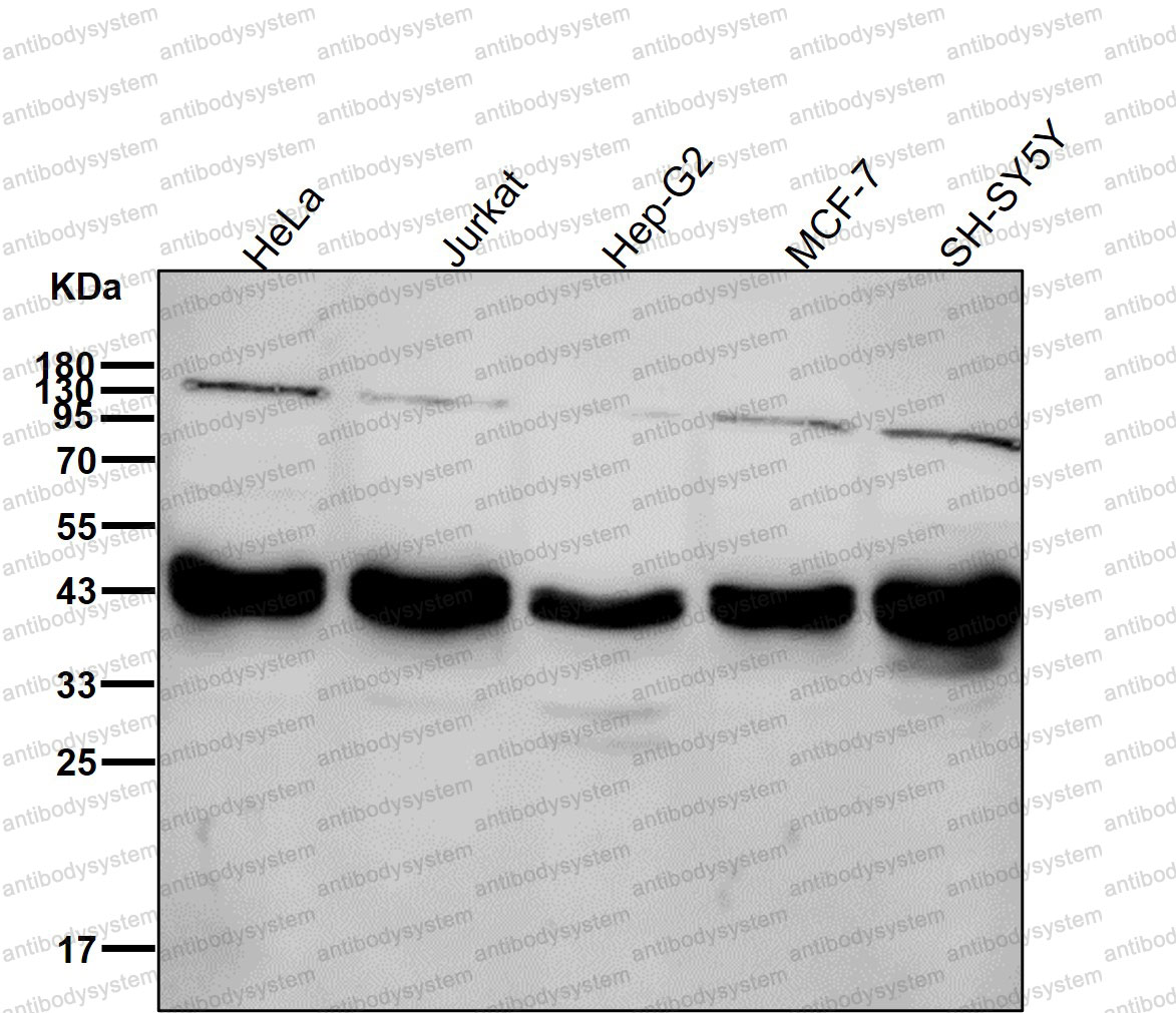 Anti-SMARCB1 Antibody (R1A54)