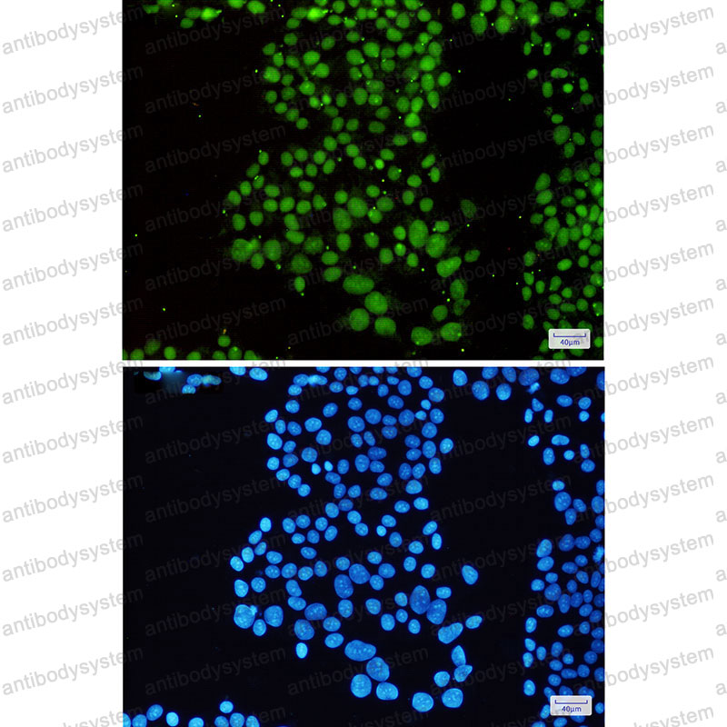 Anti-SMARCB1 Antibody (R2D38)
