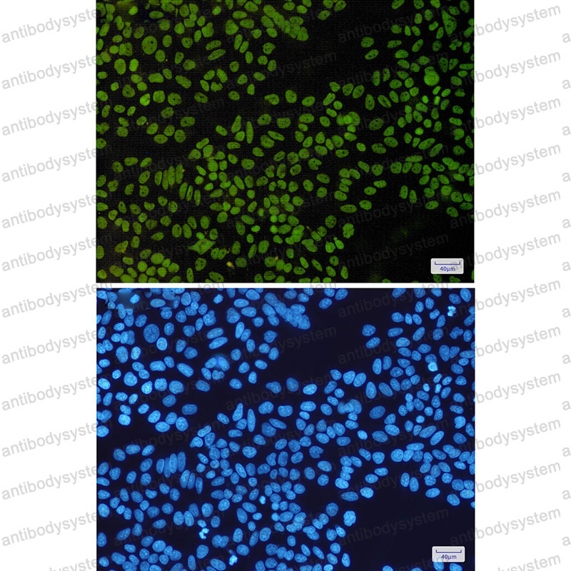 Anti-SMARCB1 Antibody (R2D39)