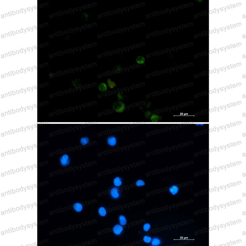 Anti-GRSF1 Antibody (R2D44)