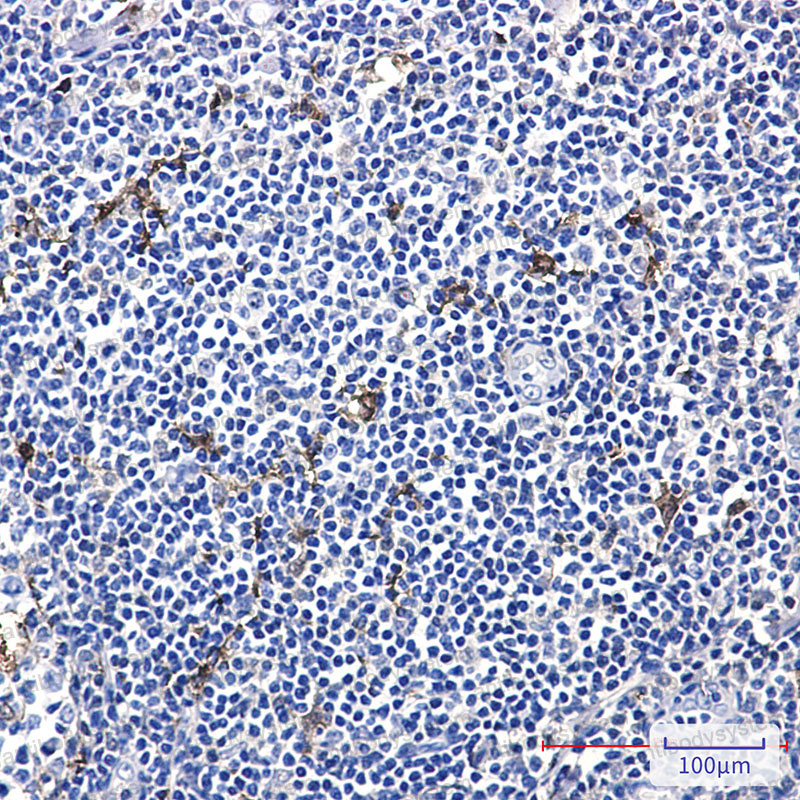 Anti-MERTK/MER Antibody (R2D45)