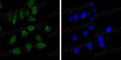 Immunofluorescence for Anti-CHD3 Antibody (R3R87) ?>