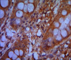 Immunohistochemical for Anti-CHD3 Antibody (R3R87) ?>