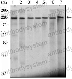 Western blot for Anti-CHD3 Antibody (R3R87) ?>