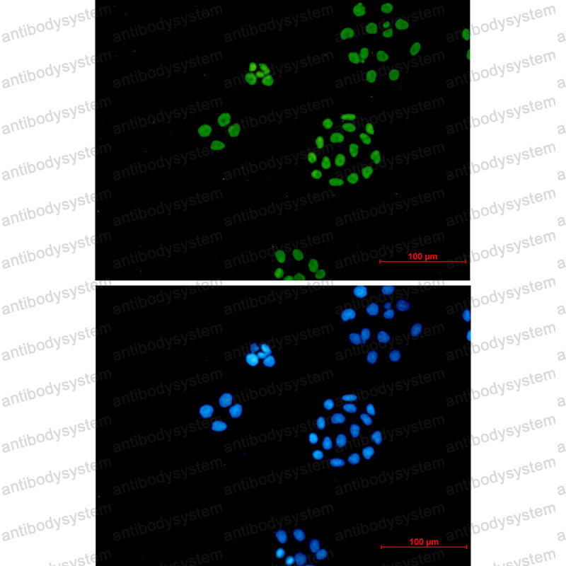 Anti-ILF3 Antibody (R2D55)