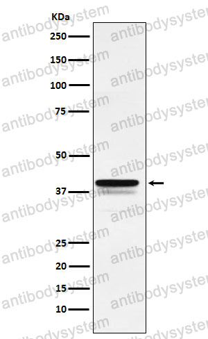 Anti-FOXF1 Antibody (R2D58)