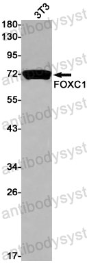 Anti-FOXC1 Antibody (R2D59)