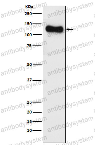 Anti-DLG1 Antibody (R2D60)