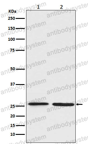 Anti-BNIP1 Antibody (R2D63)
