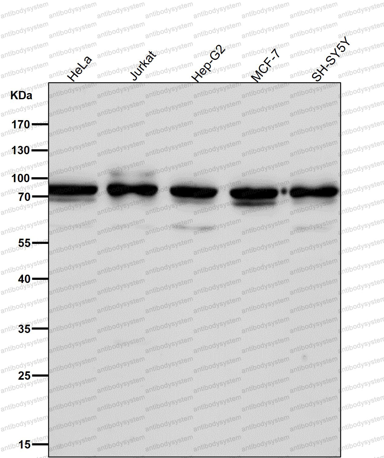 Anti-CDC16 Antibody (R1B92)
