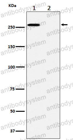Anti-Phospho-ACACA (S79) Antibody (R1A48)