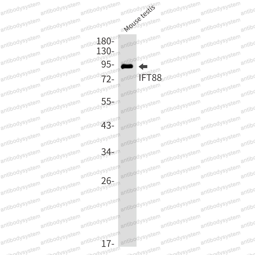 Anti-IFT88 Antibody (R2D77)