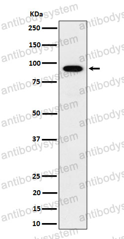 Anti-IFT88 Antibody (R2D76)