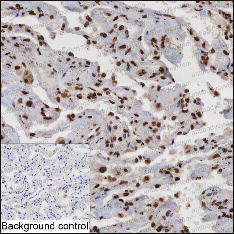 Immunohistochemical for Anti-ZBTB17 Antibody (R3S08) ?>