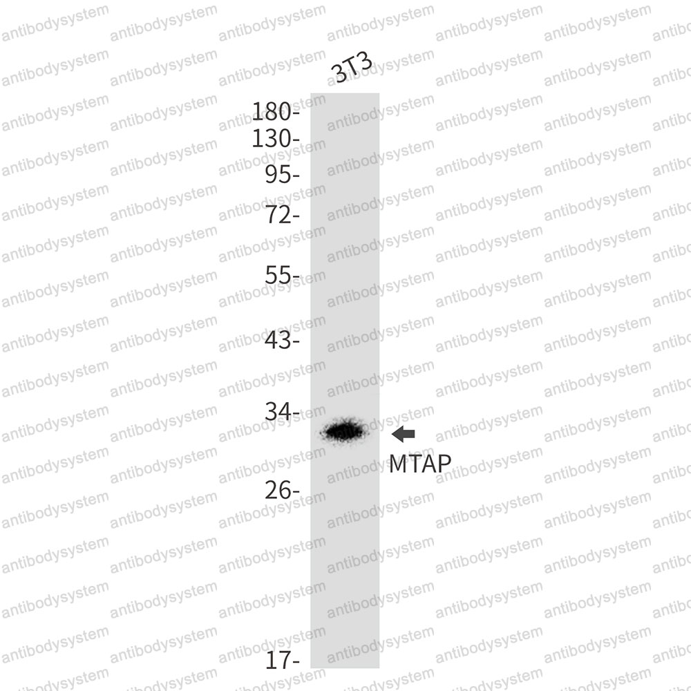Anti-MTAP Antibody (R2D83)