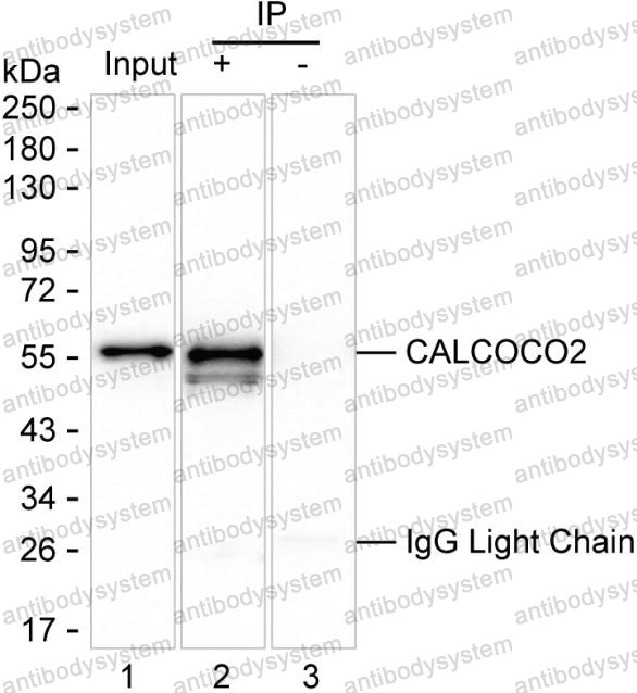 Immunoprecipitation for Anti-CALCOCO2 Antibody (R3S12) ?>