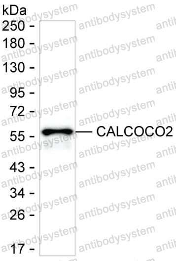 Western blot for Anti-CALCOCO2 Antibody (R3S11) ?>