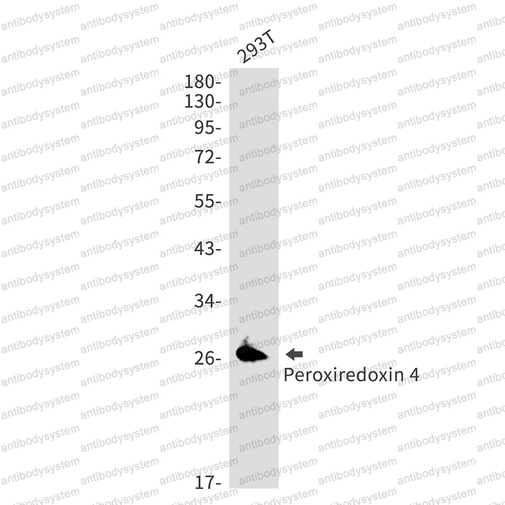 Anti-PRDX4 Antibody (R2D99)