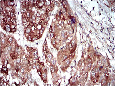 Immunohistochemical for Anti-MAP2K5 Antibody (R3S16) ?>