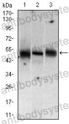 Western blot for Anti-MAP2K5 Antibody (R3S16) ?>