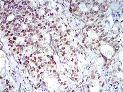 Immunohistochemical for Anti-MAPK7 Antibody (R3S17) ?>