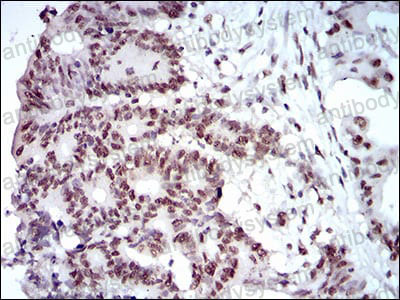 Immunohistochemical for Anti-MAPK7 Antibody (R3S17) ?>