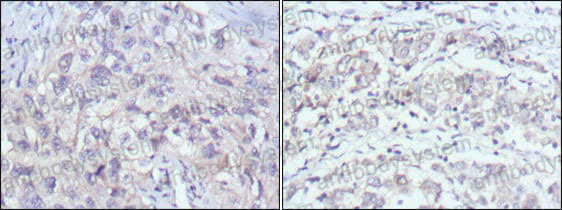 Immunohistochemical for Anti-PAK2 Antibody (R3S18) ?>