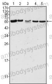 Western blot for Anti-PAK2 Antibody (R3S18) ?>