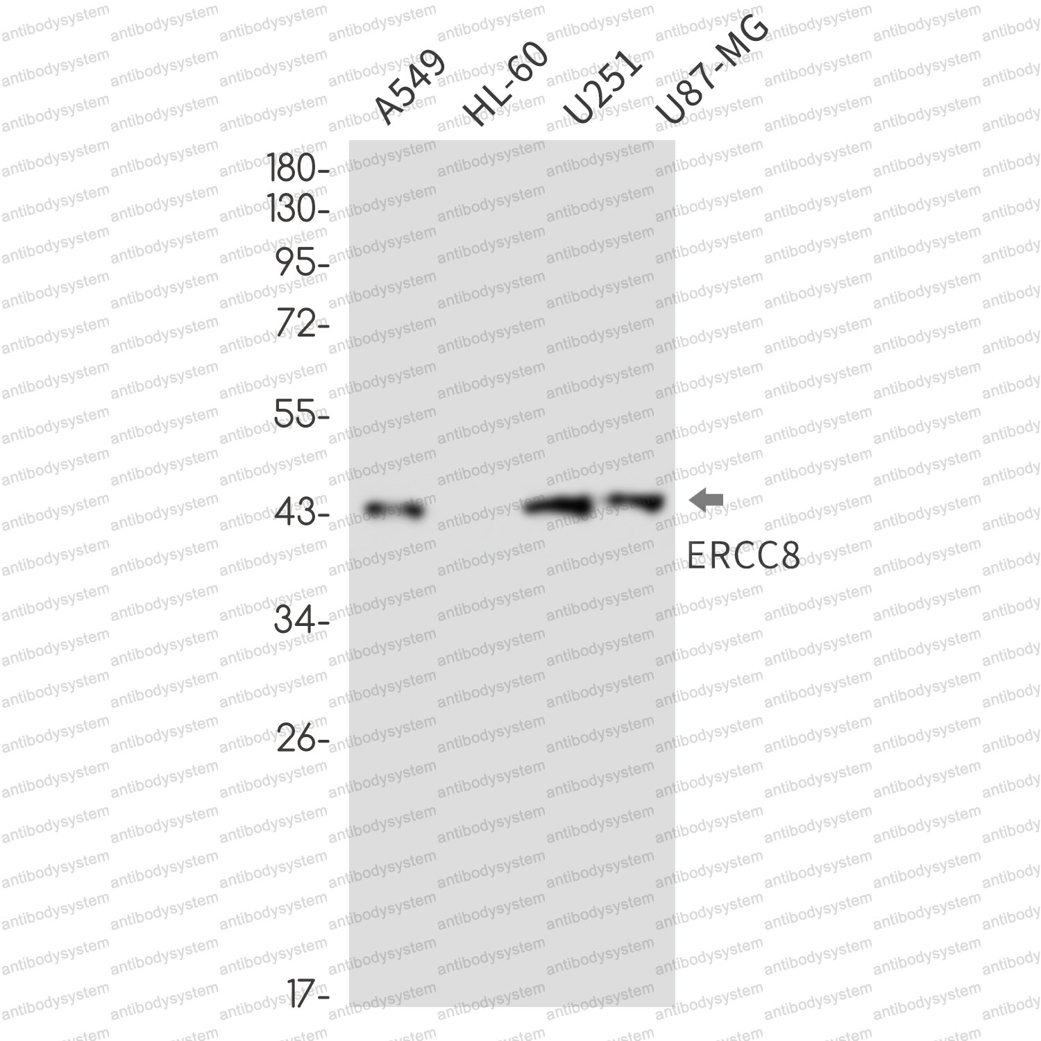 Anti-ERCC8 Antibody (R2E08)