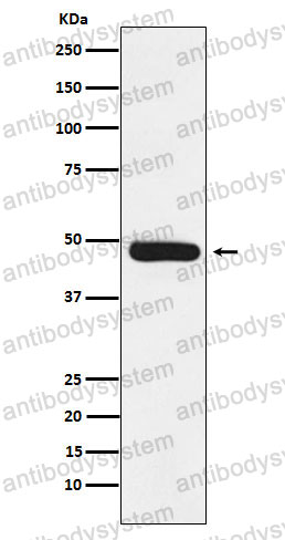 Anti-ERCC8 Antibody (R2E07)