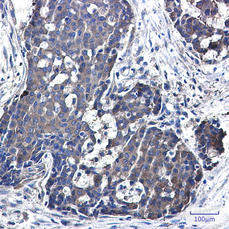 Anti-NME3 Antibody (R2E09)