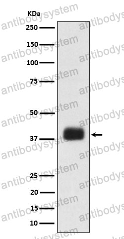 Anti-SRSF6 Antibody (R2E10)