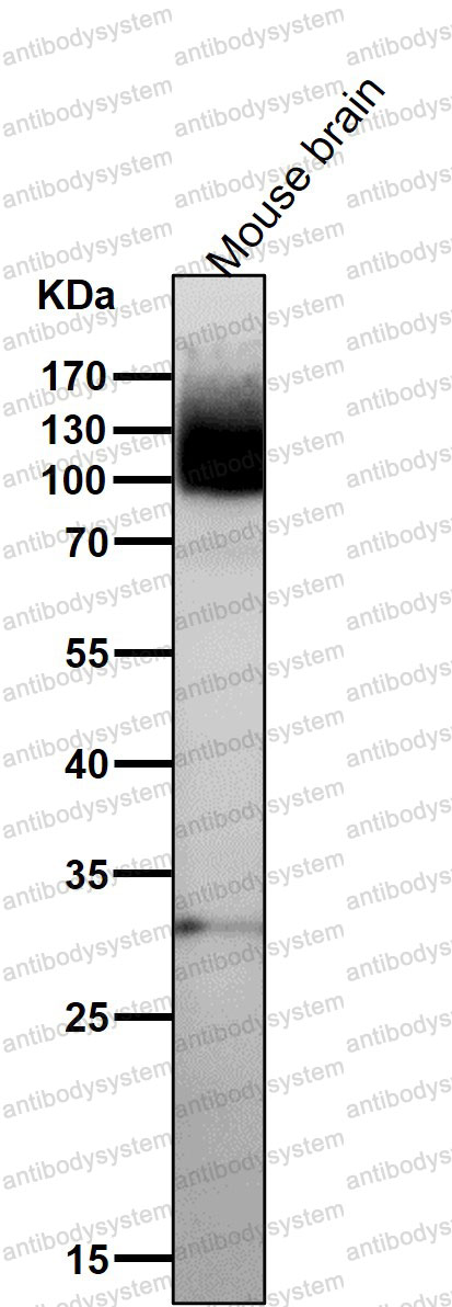 Anti-GRM1 Antibody (R2E11)