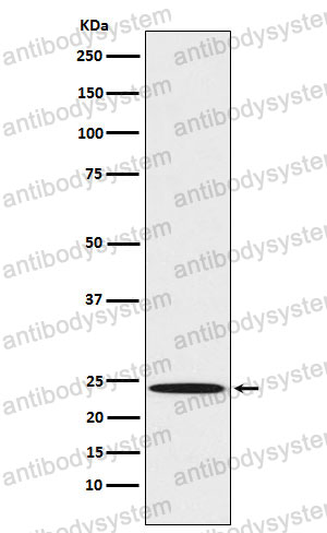 Anti-MAD2L1/MAD2 Antibody (R2E12)