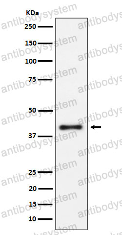 Anti-CD215/IL15RA Antibody (R2E13)