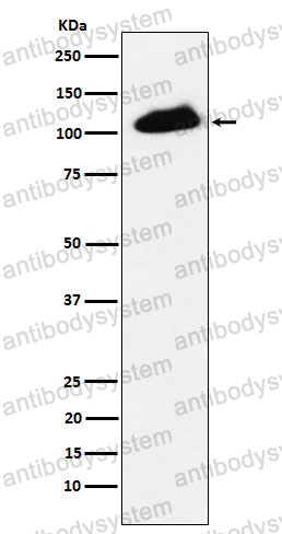 Anti-Phospho-TRIM28/KAP1 (S824) Antibody (R2E14)