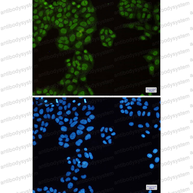 Anti-TRIM28 Antibody (R2E15)