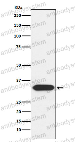Anti-STX3 Antibody (R2E16)