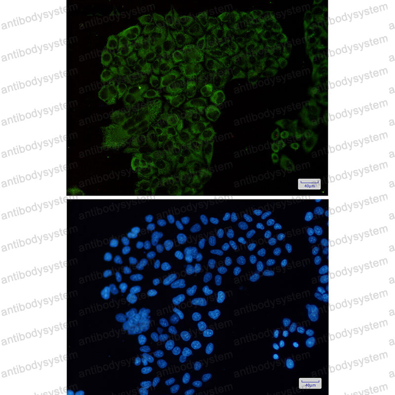 Anti-G3BP1 Antibody (R2E18)