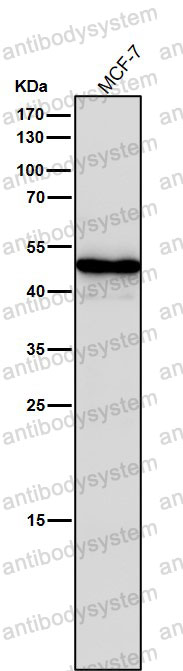Anti-NR5A1 Antibody (R2E20)