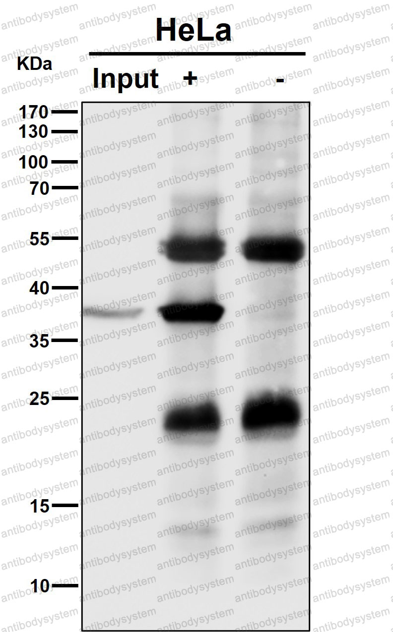 Anti-NMI Antibody (R1B09)
