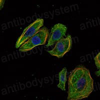 Immunofluorescence for Anti-SCGB2A2 Antibody (R3S29) ?>