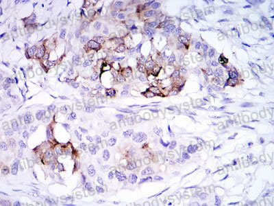Immunohistochemical for Anti-SCGB2A2 Antibody (R3S29) ?>