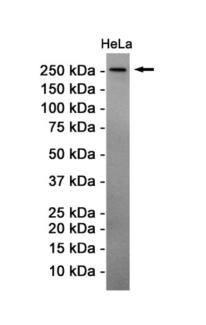 Anti-ATM Antibody (R2E24)