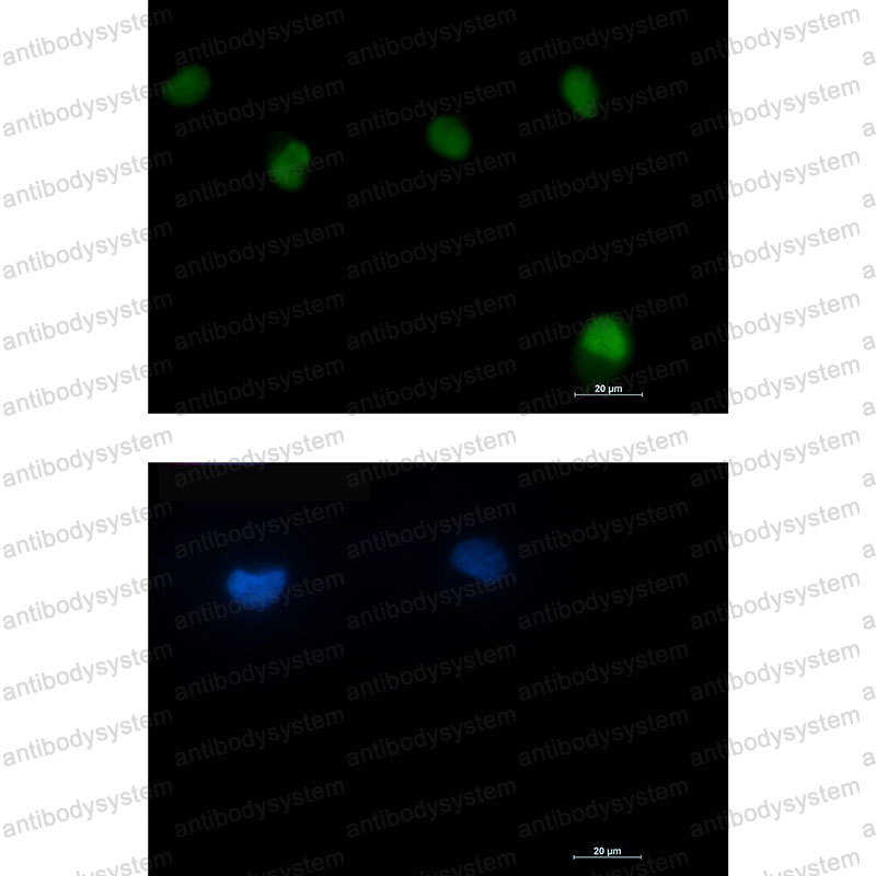 Anti-ATM Antibody (R2E23)