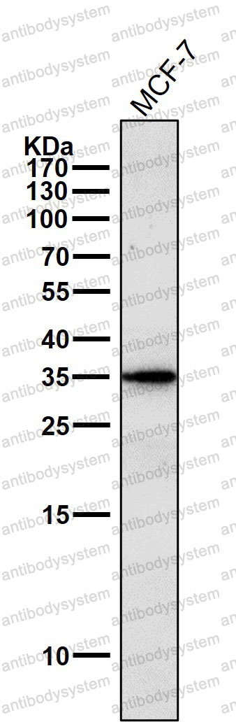 Anti-SGCG Antibody (R2E25)