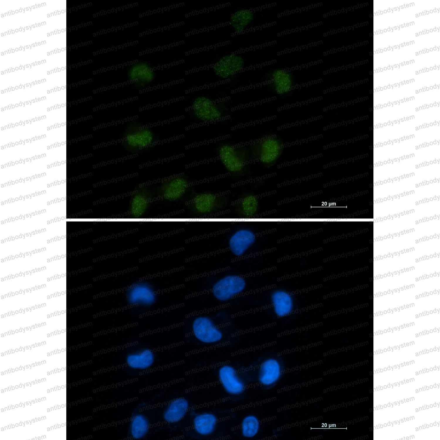 Anti-CTBP1 Antibody (R2E27)