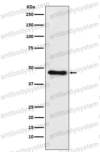 Anti-CTBP1 Antibody (R2E26)