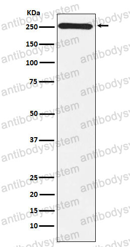 Anti-MYO7A Antibody (R2E28)