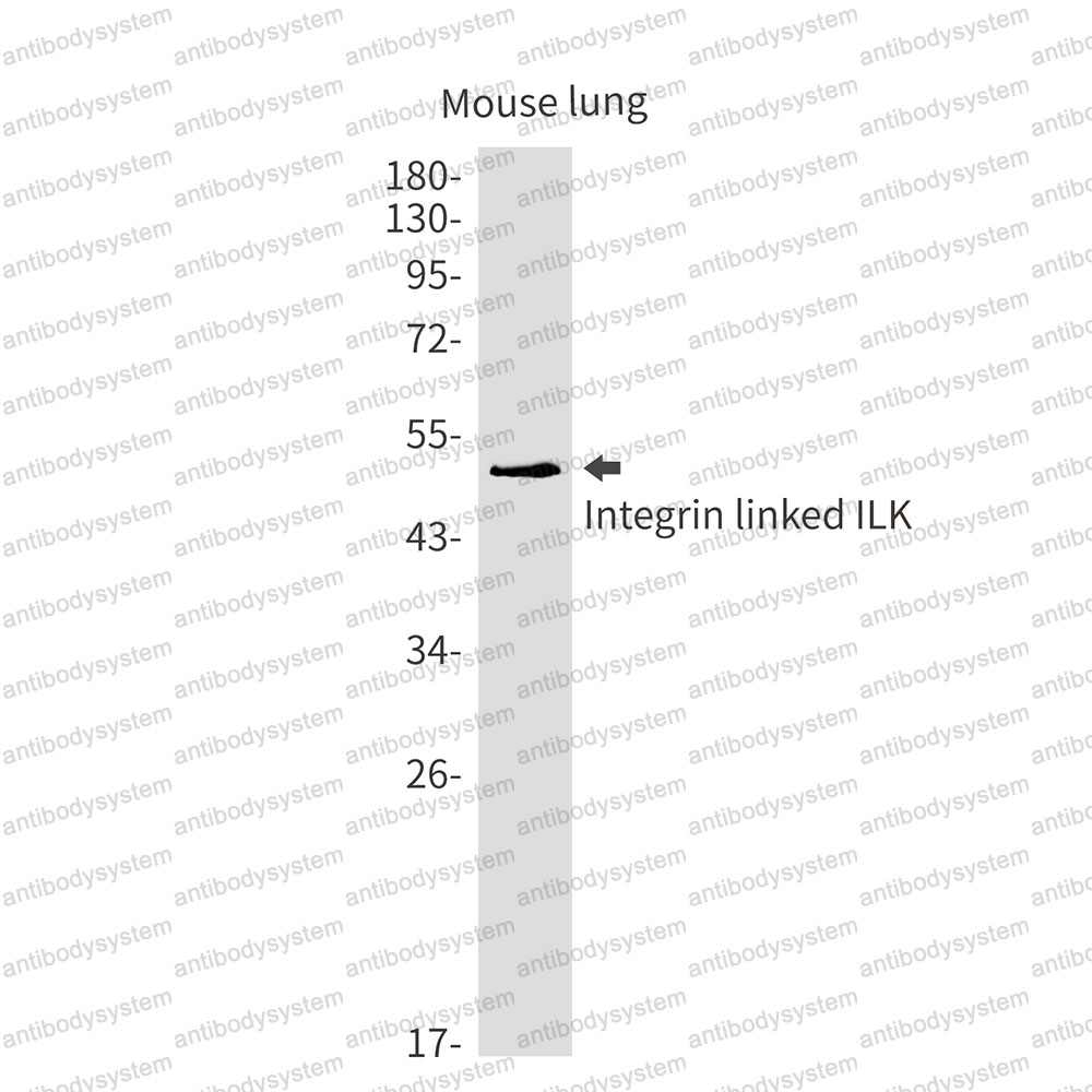 Anti-ILK Antibody (R2E29)